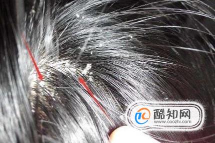 ���ʶ��ͷ���Ƿ�����������